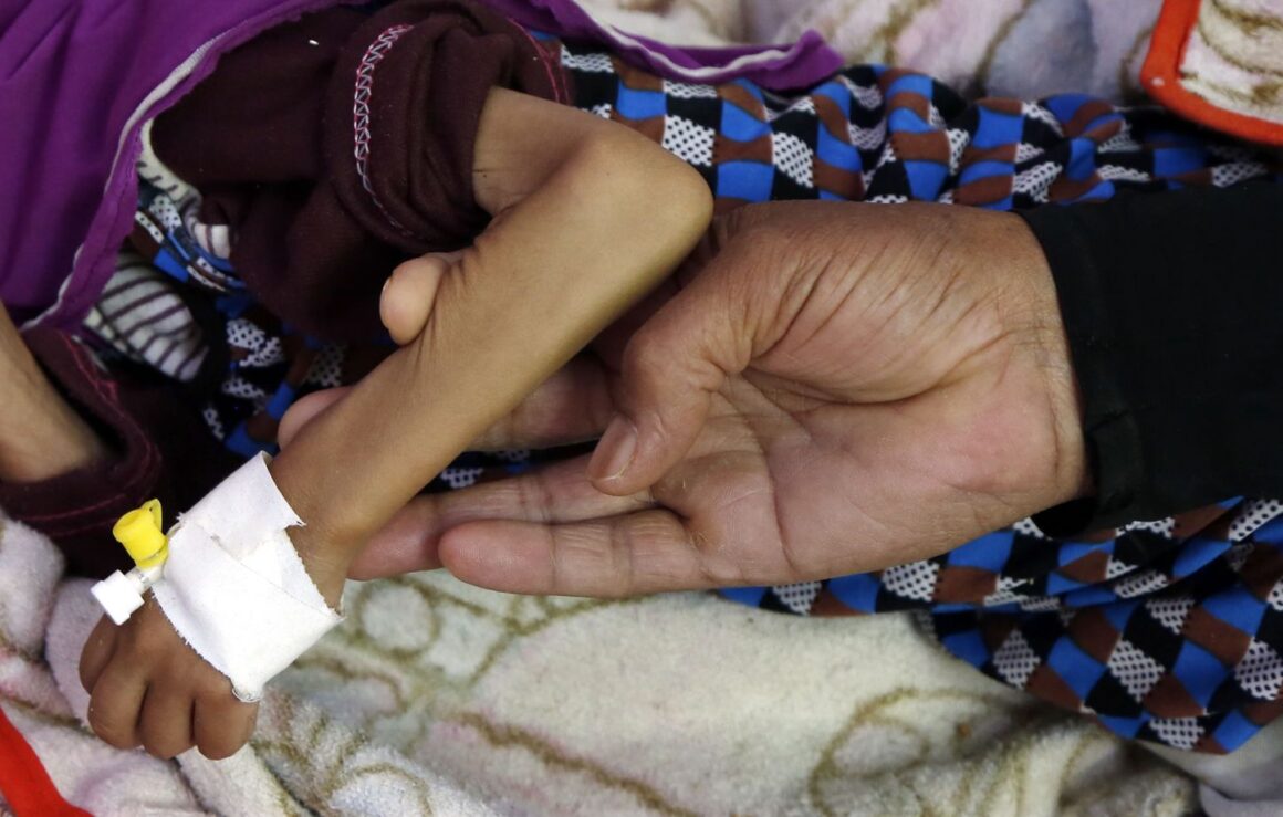 malnutrition diabète