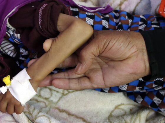 malnutrition diabète