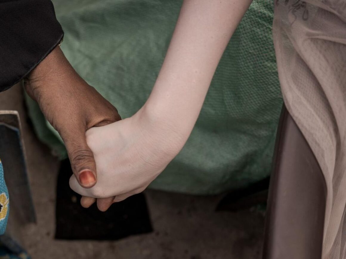 gène couleur de la peau