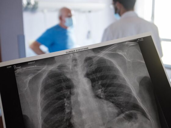 lame de couteau thorax