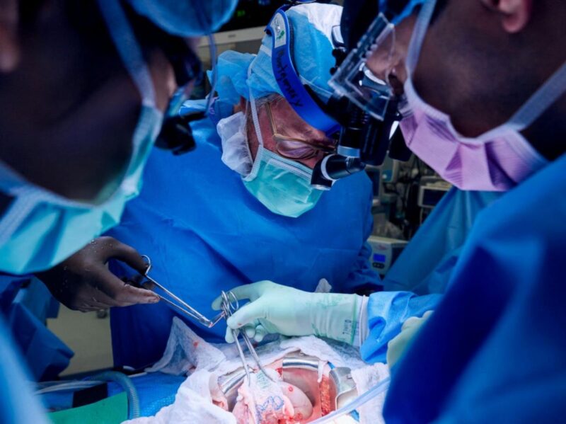 xénotransplantation