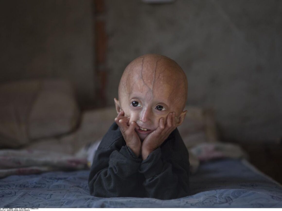 gènes des centenaires