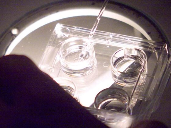 congélation ovocytes