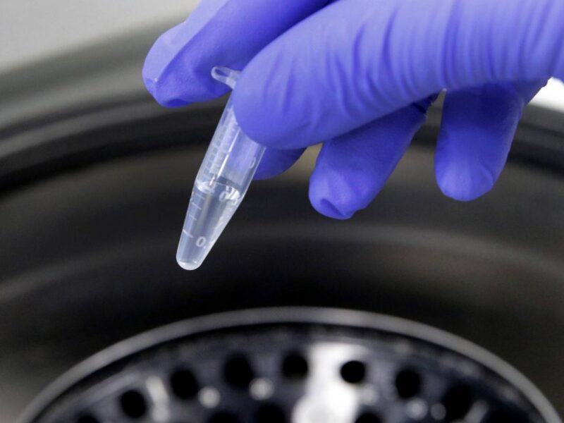 microbiote intestinal enfants