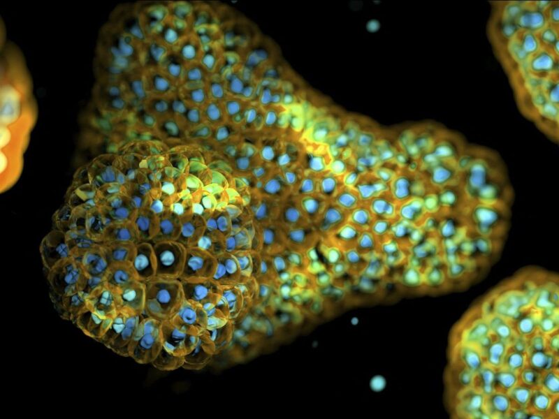 organoïdes pulmonaires