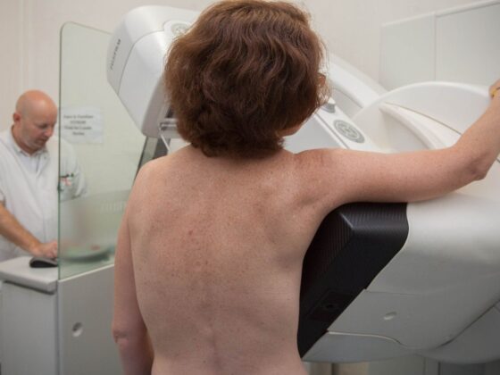 registre national des cancers