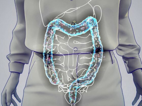 slip intelligent péter