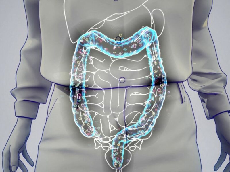 slip intelligent péter