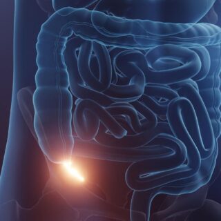 appendicite antibiotiques