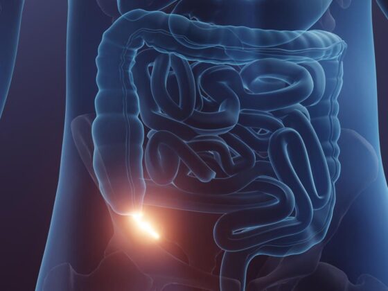 appendicite antibiotiques