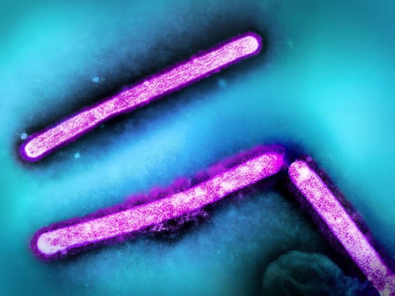 supermicroscope grippe