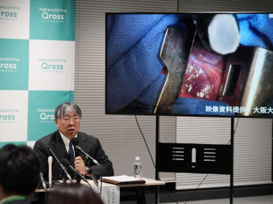 traitement cellules souches Parkinson