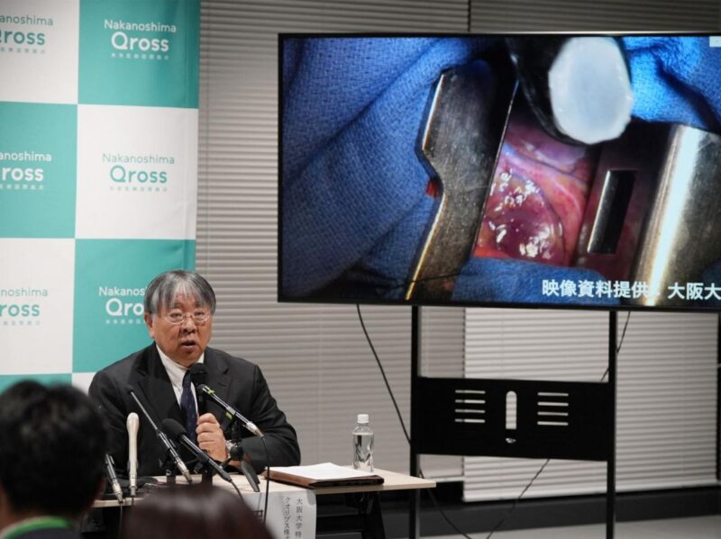 traitement cellules souches Parkinson