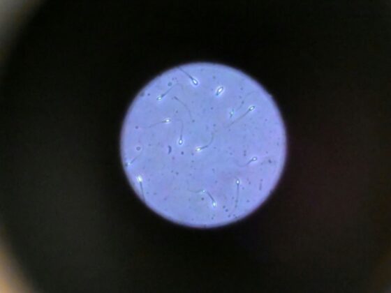 spermatozoïdes espace