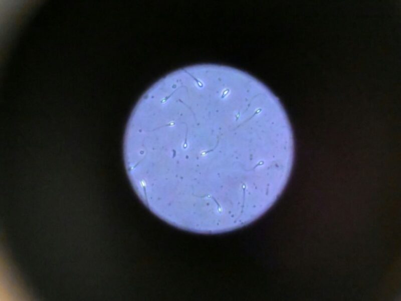 spermatozoïdes espace