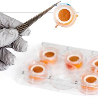 recyclage de la peau