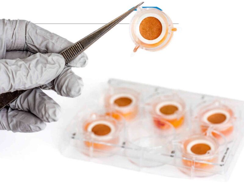 recyclage de la peau